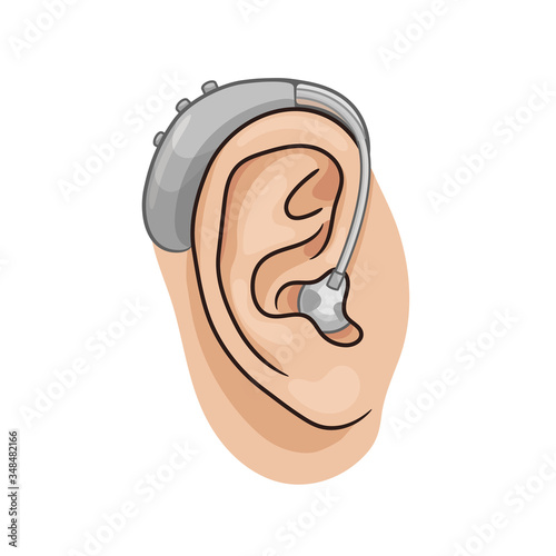 Hearing aid behind the ear, electronic device, BTE type. Hearing loss vector illustration, realistic style