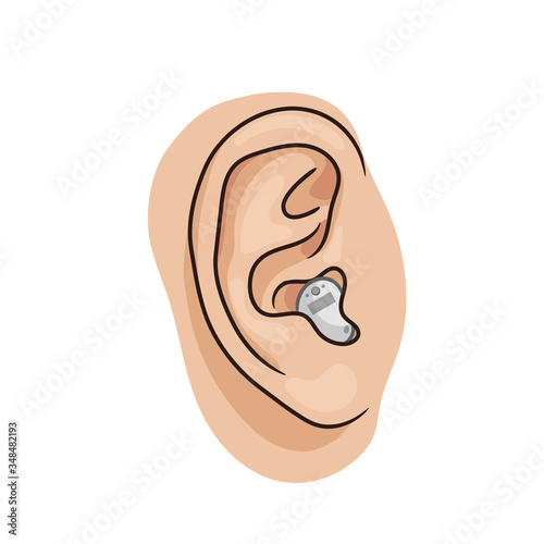 Hearing aid, electronic device, in-the-canal  ITC type. Hearing loss vector illustration, human ear realistic style