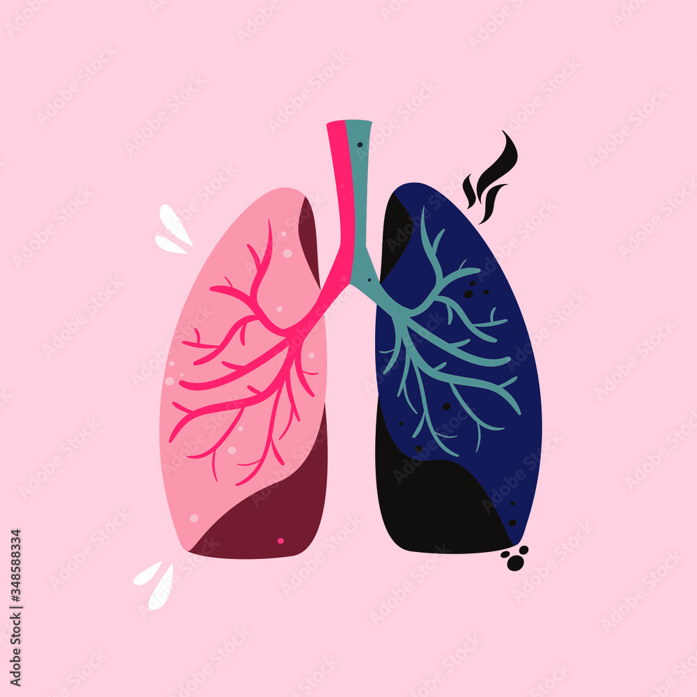 Healthy and unhealthy lungs vector illustration. Smoker's disease