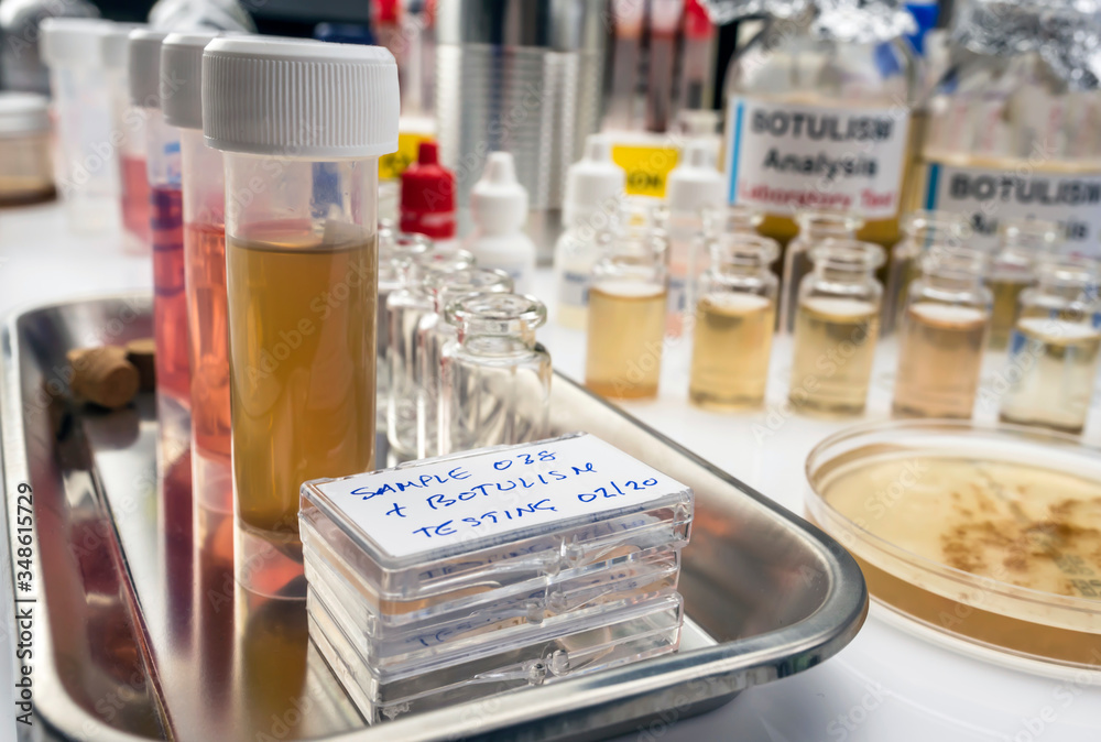 Samples contaminated by Clostridium botulinum toxin that causes botulism in humans, laboratory research, conceptual image Samples contaminated by Clostridium botulinum toxin that causes botulism in humans, laboratory research, conceptual image