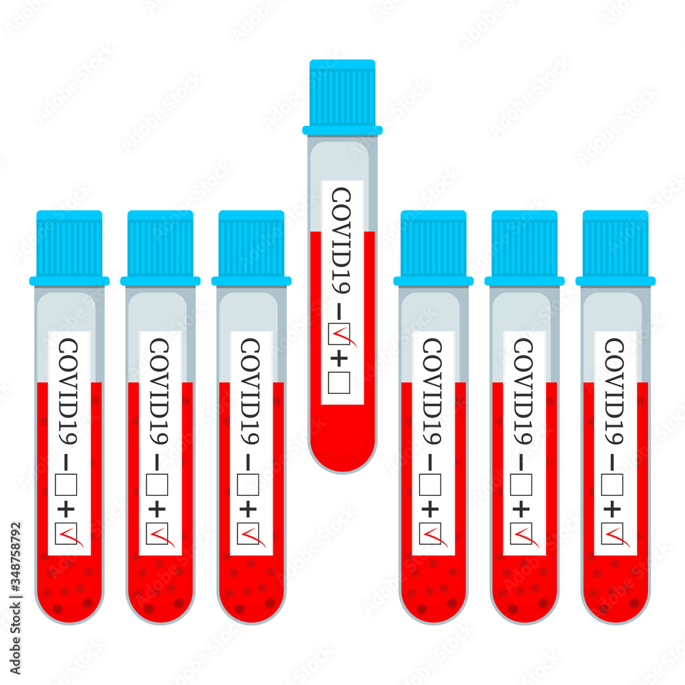 Set of glass tubes with blood for test on covid-19, coronavirus. All tests are positive, one negative. Blood samples. Virus analysis for laboratory. Vector illustration on white background.
Set of glass tubes with blood for test on covid-19, coronavirus. All tests are positive, one negative. Blood samples. Virus analysis for laboratory. Vector illustration on white background.