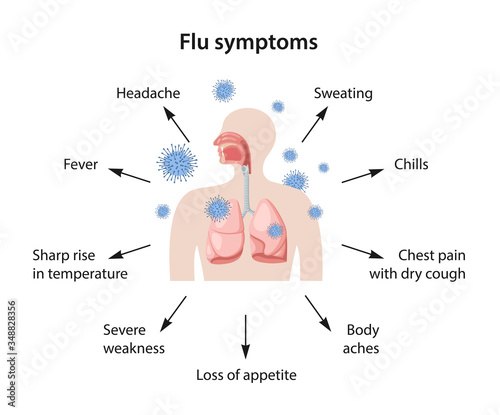 Influenza. Human body with lungs is attacked by influenza viruses. Flu Symptoms as a Text. Vector illustration in flat style isolated on white background.