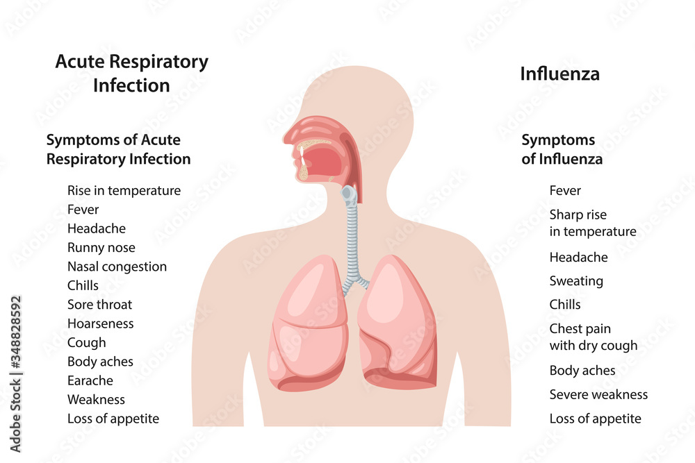 viral respiratory infection