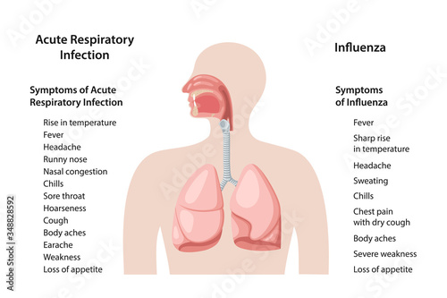 Differences between symptoms of Acute Respiratory Viral Infection and influenza. ARVI symptoms. Symptoms of Flu. Vector illustration in flat style isolated over white background