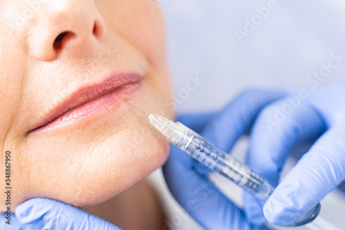 Patient receiving a micro-injection in the bottom lip