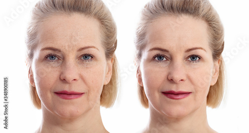 Foto Middle age close up woman happy face before after cosmetic procedures