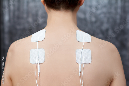 TENS therapy in fibromyalgia and cervicalgia treatment - electrodes placed on female patient's shoulders. photo