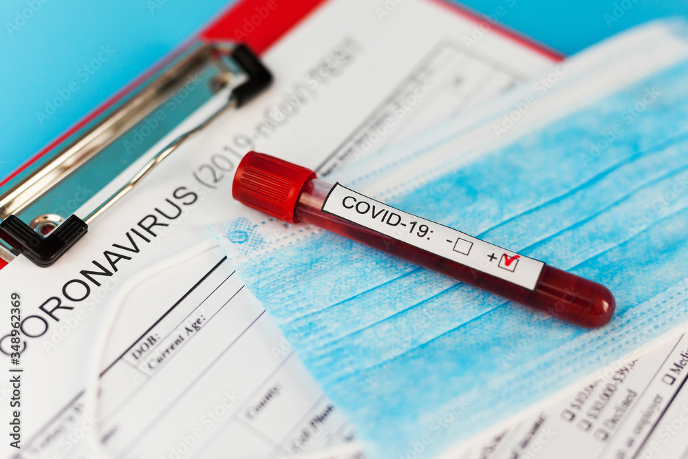 Positive blood test result for the new rapidly spreading Coronavirus Positive blood test result for the new rapidly spreading Coronavirus