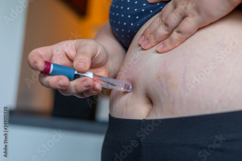 Overweight woman applying diabetes medicine injection into her belly