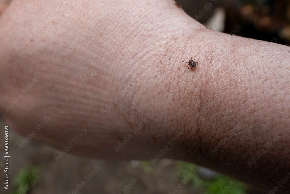 Fototapeta premium Tick on a man’s hand