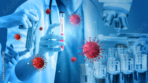 Coronavirus COVID-19 medical test vaccine research and development concept. Scientist in laboratory study and analyze scientific sample of Coronavirus antibody to produce drug treatment for COVID-19.