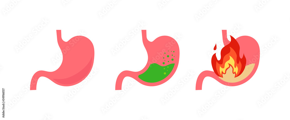 Stomach set vector for medicine. Isolated flat illustration Stomach set vector for medicine. Isolated flat illustration