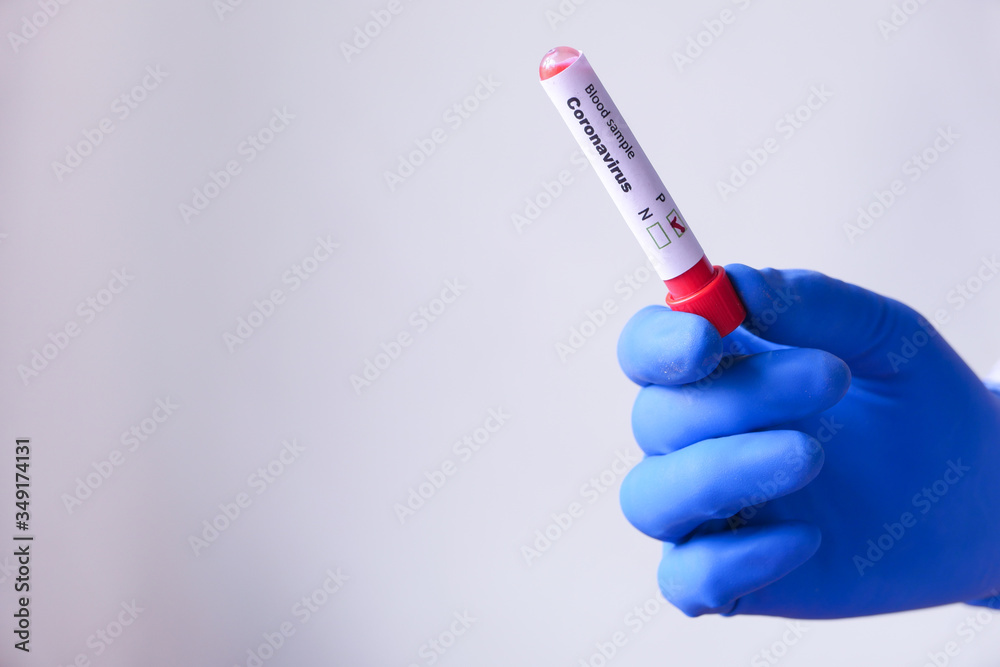 Obraz premium laboratory technician hand holding blood test tube 