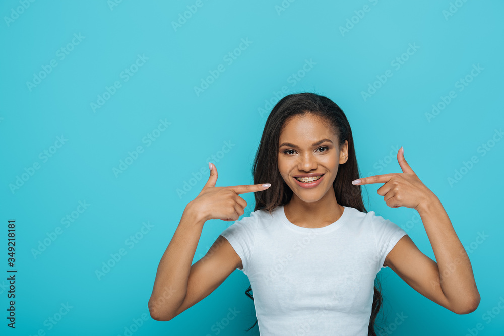 happy african american girl smiling at camera while pointing at braces on her teeth on blue background happy african american girl smiling at camera while pointing at braces on her teeth on blue background