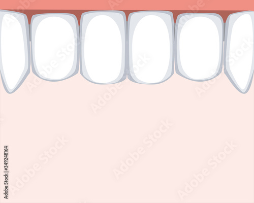Teeth on the upper jaw after visiting the orthodontic clinic as a concept of healthy molars and incisors, vector stock illustration, place for text and copy space