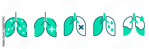 Pneumonia, human lung inflammation, coronavirus progression flat illustration