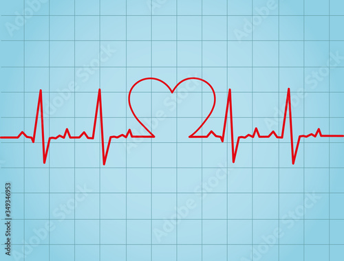heart beat cardiogram
