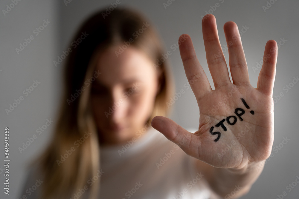 Woman with bruises on her face showing stop sign, palm in focus - obrazy, fototapety, plakaty 