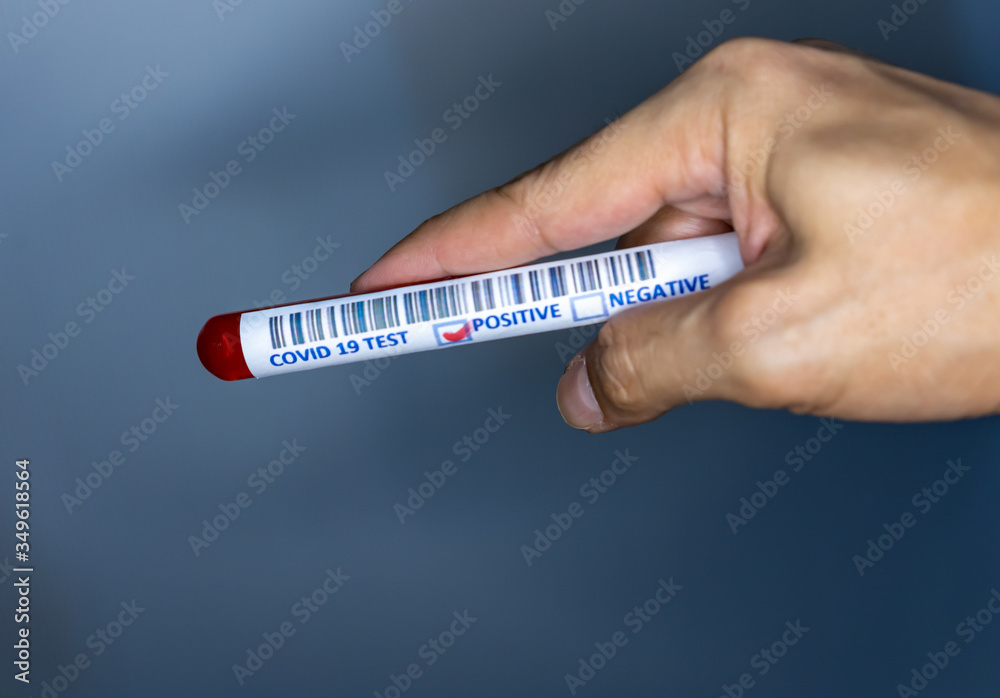 Obraz premium Hand holding a test tube with blood for covid 19 testing. Test tube used for corona virus testing. Covid 19 positive result