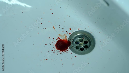 Dark blood dripping on a white washbasin