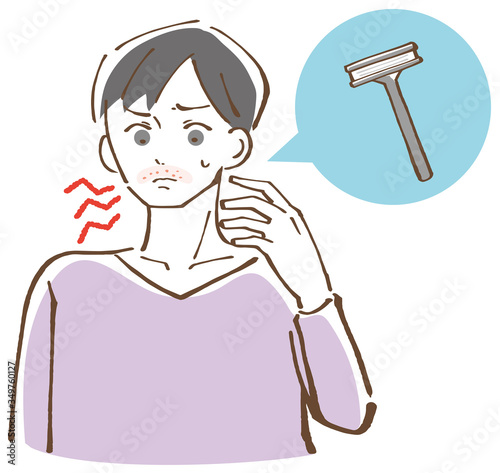 カミソリ負けを起こしている男性　イラスト