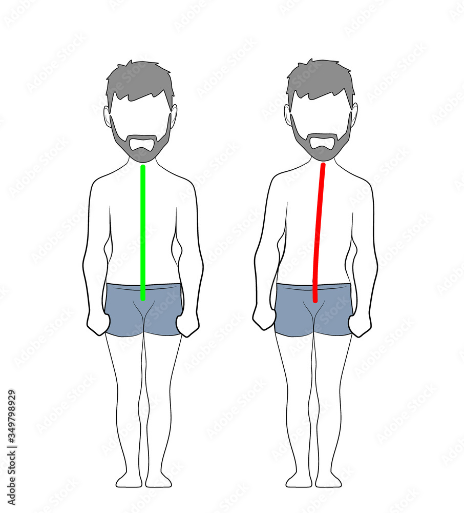 Correct alignment of human body in standing posture for good ... Biology Diagrams