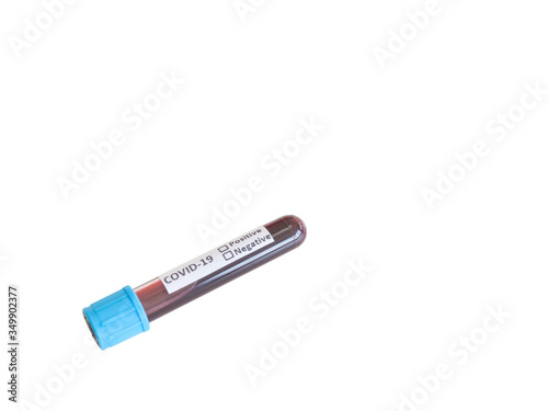 The sample blood tube test of Coronavirus (COVID-19) is on the white desk.