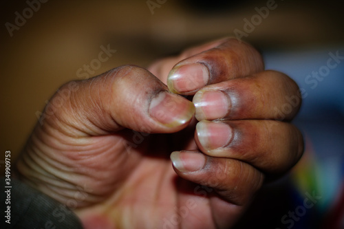 close-up male hand showing long raw nails, dirty nails