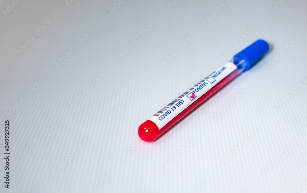 Blurry image of a Sample blood in test tube of Coronavirus (Covid-19). Coronavirus Covid 19 infected blood sample in a test tube Blurry image of a Sample blood in test tube of Coronavirus (Covid-19). Coronavirus Covid 19 infected blood sample in a test tube