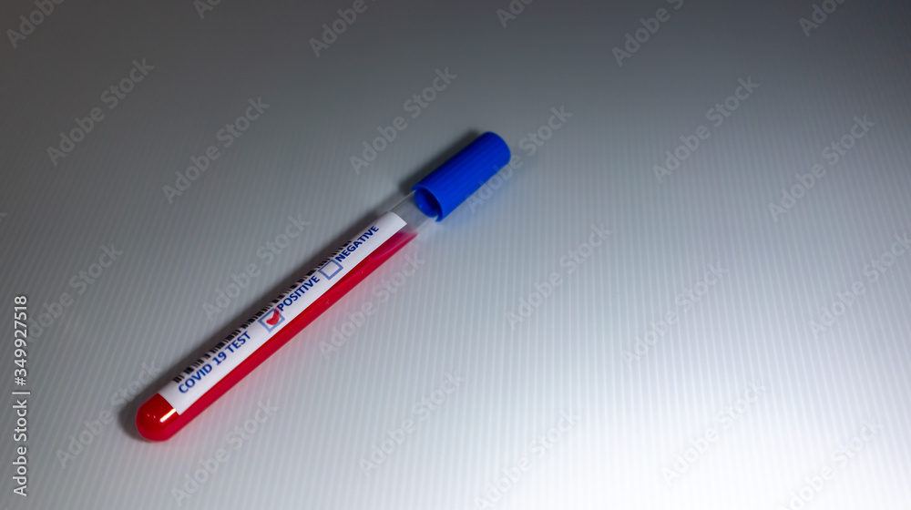 Blurry image of a Sample blood in test tube of Coronavirus (Covid-19). Coronavirus Covid 19 infected blood sample in a test tube Blurry image of a Sample blood in test tube of Coronavirus (Covid-19). Coronavirus Covid 19 infected blood sample in a test tube