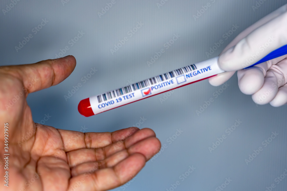 Obraz premium Blurry image of a hand while holding a test tube containing a patient’s sample that has tested positive for coronavirus and giving it to another person not wearing gloves