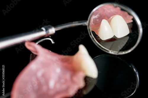 Dental prosthetic isolatic - partial denture upper side. photo