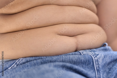 Принти на полотні Woman with paunchy and many ply of belly fat