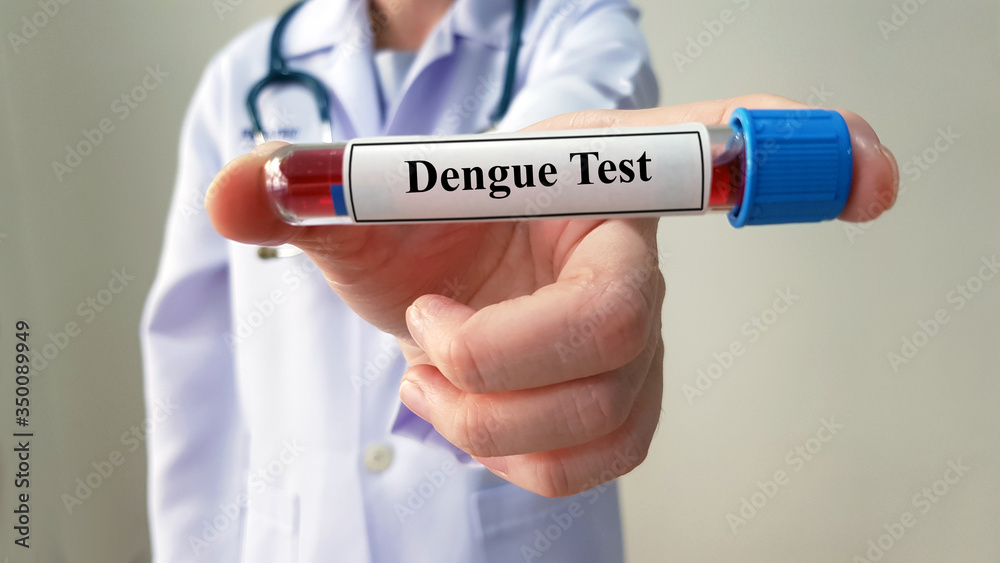 Doctor show positive Dengue test and laboratory sample of blood testing for diagnosis Dengue virus infection. Tropical infectious and Diagnostic technology for screening viral pandemic disease concept Doctor show positive Dengue test and laboratory sample of blood testing for diagnosis Dengue virus infection. Tropical infectious and Diagnostic technology for screening viral pandemic disease concept