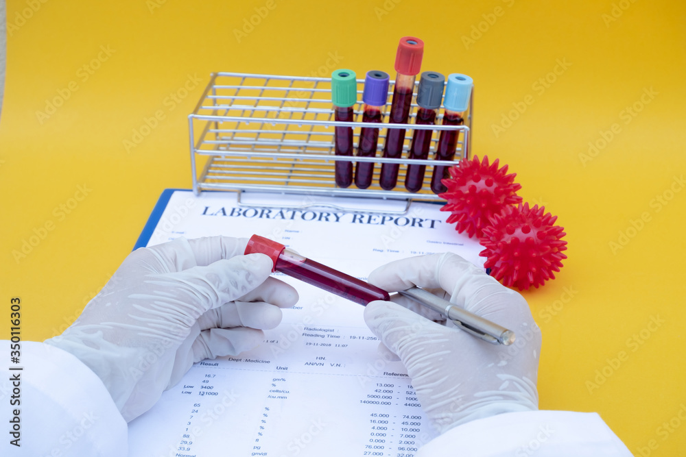 professional-doctors-perform-covid-19-tests-from-samples-of-blood-tests