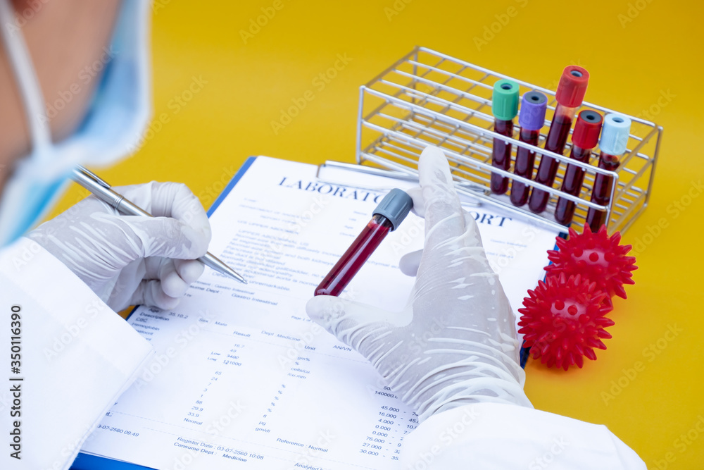 Professional doctors perform COVID-19 tests from samples of blood tests to diagnose coronary virus infections analysis and sampling of infectious diseases, medical concepts and health care