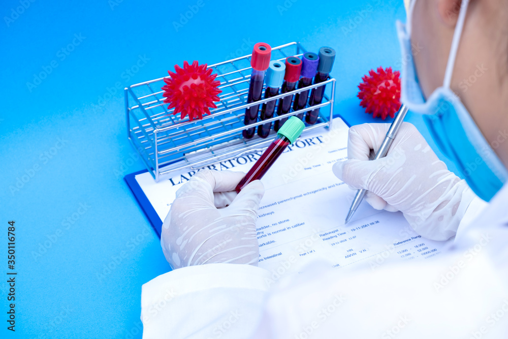 Professional doctors perform COVID-19 tests from samples of blood tests ...