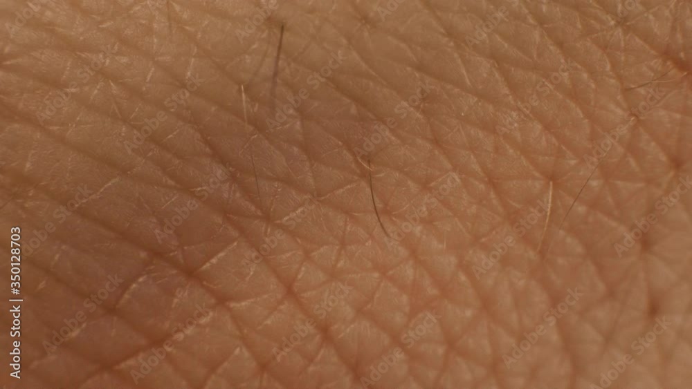 Human skin texture, close-up. Dry skin care concept. Moisturizing and nourishing the skin, background, epidermis Human skin texture, close-up. Dry skin care concept. Moisturizing and nourishing the skin, background, epidermis
