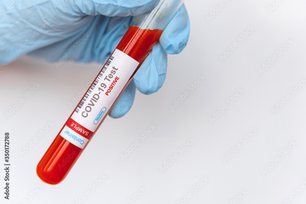 Naklejka premium Coronavirus covid 19 infected blood sample in tube in hand of scientist on white background. New virus covid-19 vaccine research.