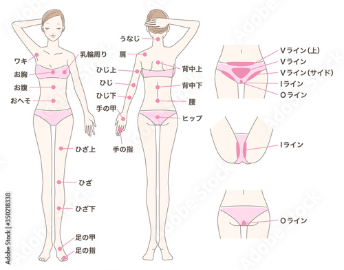 女性 脱毛 全身