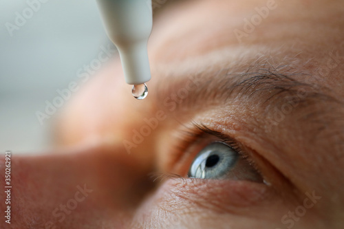 Canvas-taulu Man drops eye drops install lenses, moisturizing