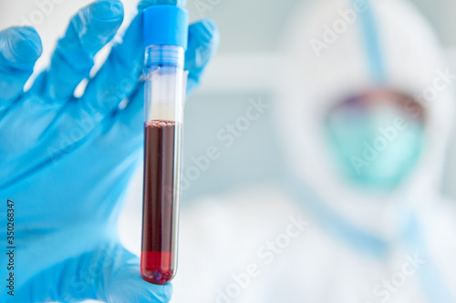 Fototapeta Naklejka Na Ścianę i Meble -  Scientist in the laboratory stops taking blood