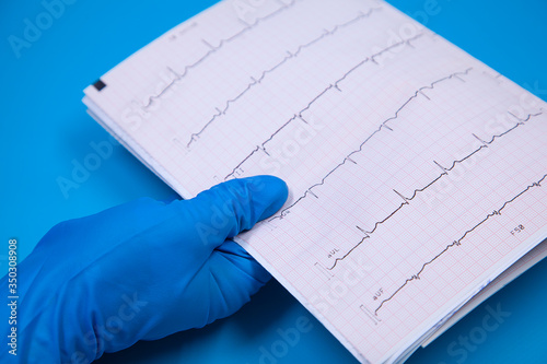 ECG strip given by hand in medical glove, blue background