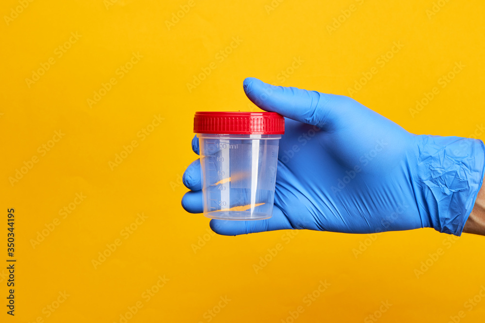 medical exam concept. perosn holds urine test cup over bright yellow background. medical exam concept. perosn holds urine test cup over bright yellow background.