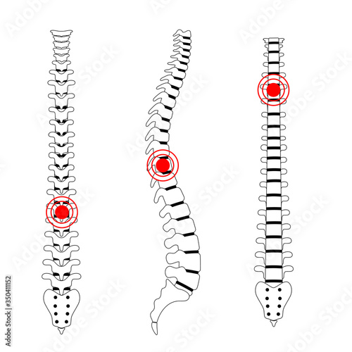 Human spine pain vector illustration