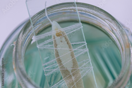 Patterns and backgrounds of Parasitic, Study of Parasitic and Anatomical pathology in laboratory.
 photo