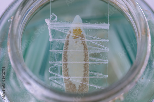 Patterns and backgrounds of Parasitic, Study of Parasitic and Anatomical pathology in laboratory.
 photo
