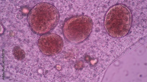 Amoebae move and feed by using pseudopods, which are bulges of cytoplasm formed by the coordinated action of actin microfilaments pushing out the plasma membrane that surrounds the cell.
 photo