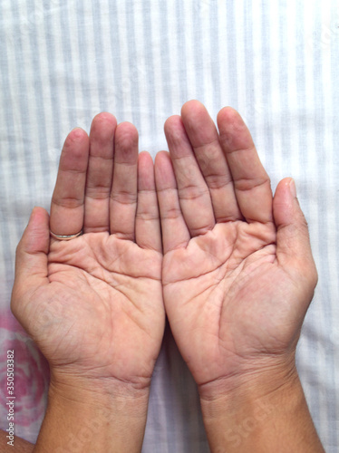 wrinkled hands/fingers because of soak in the water for a long time