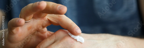 Male hard hands with calluses apply moisturizer